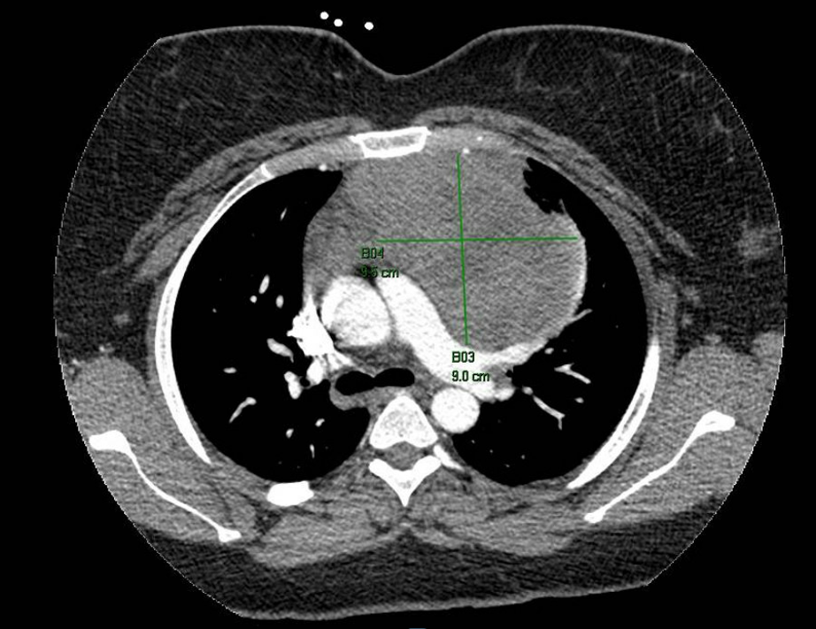 Fig 1