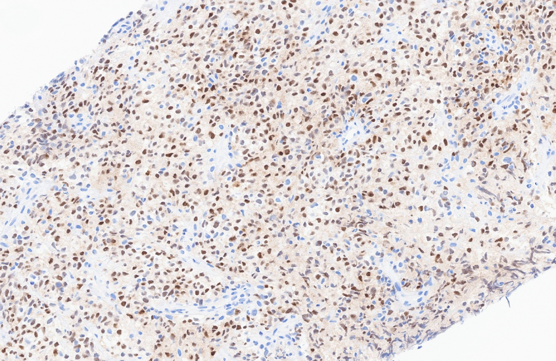 Fig 11