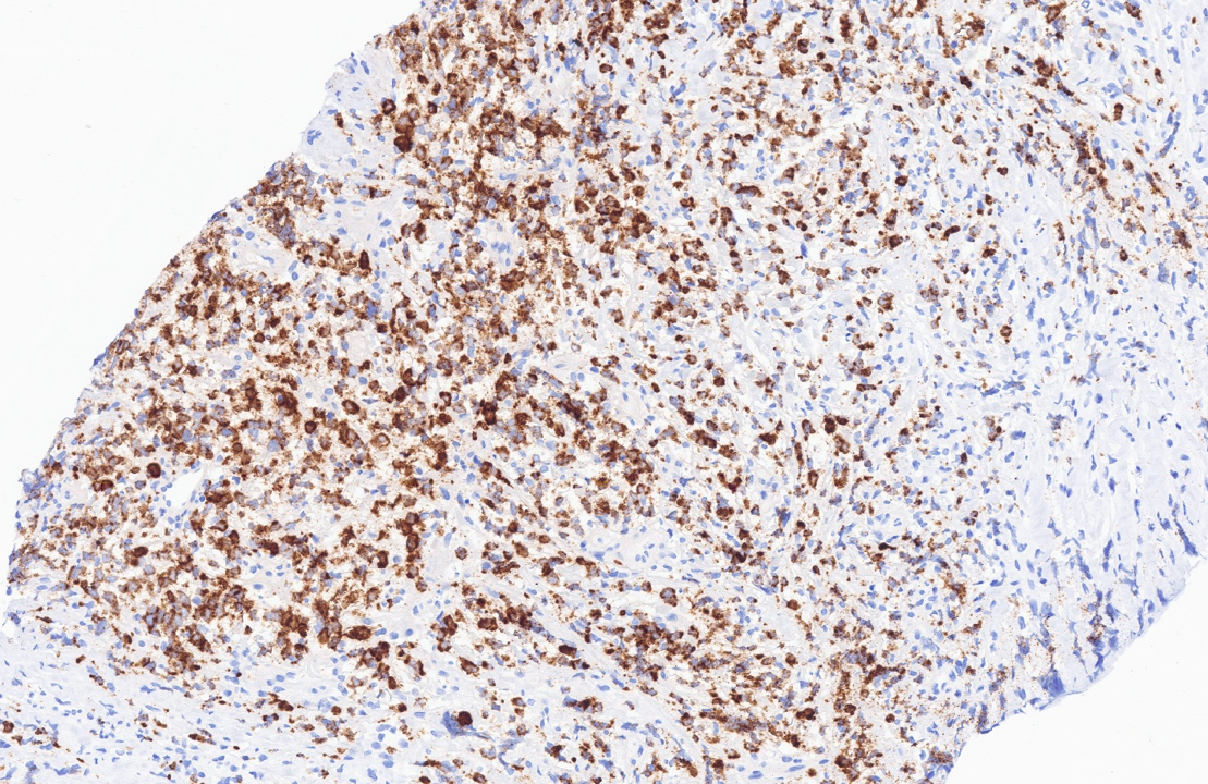 Fig 12