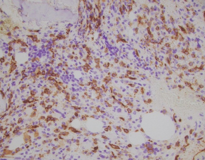 Figure 2B