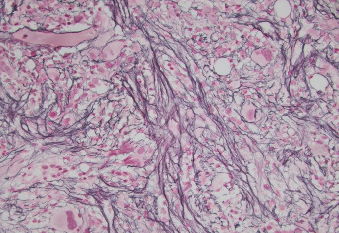 Figure 2D