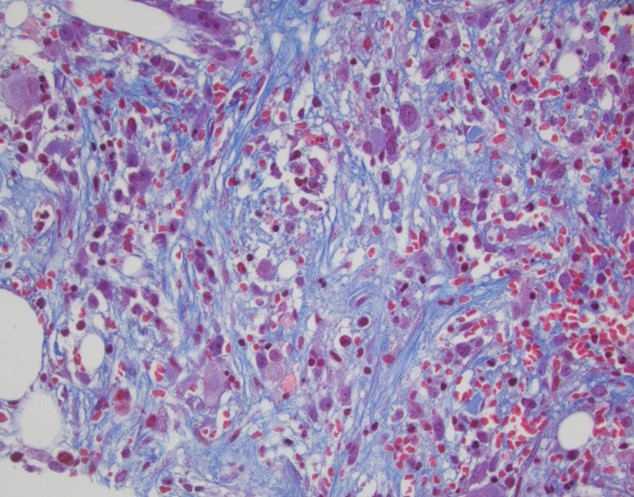 Figure 2e