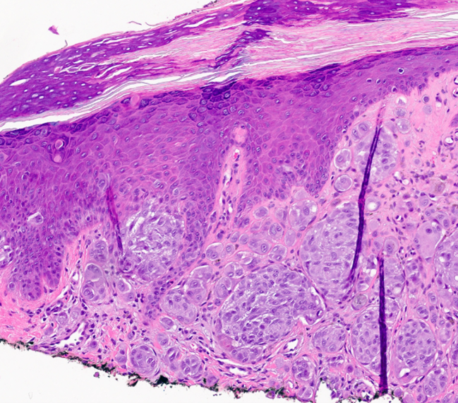 Figure C